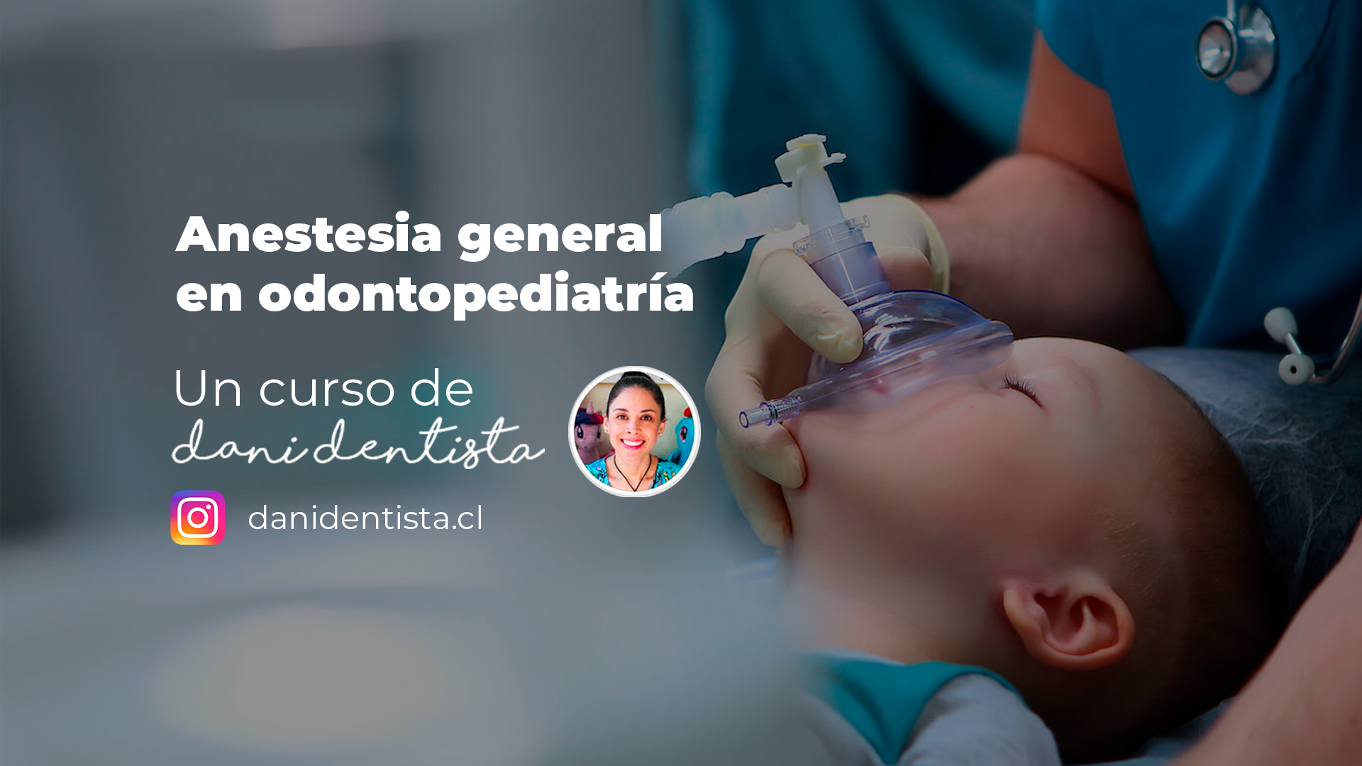 Anestesia general en odontopediatria